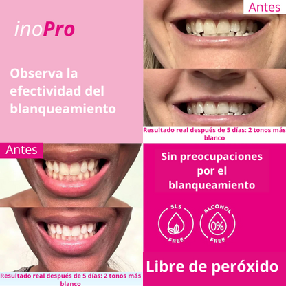 Strips Blanqueador Dental